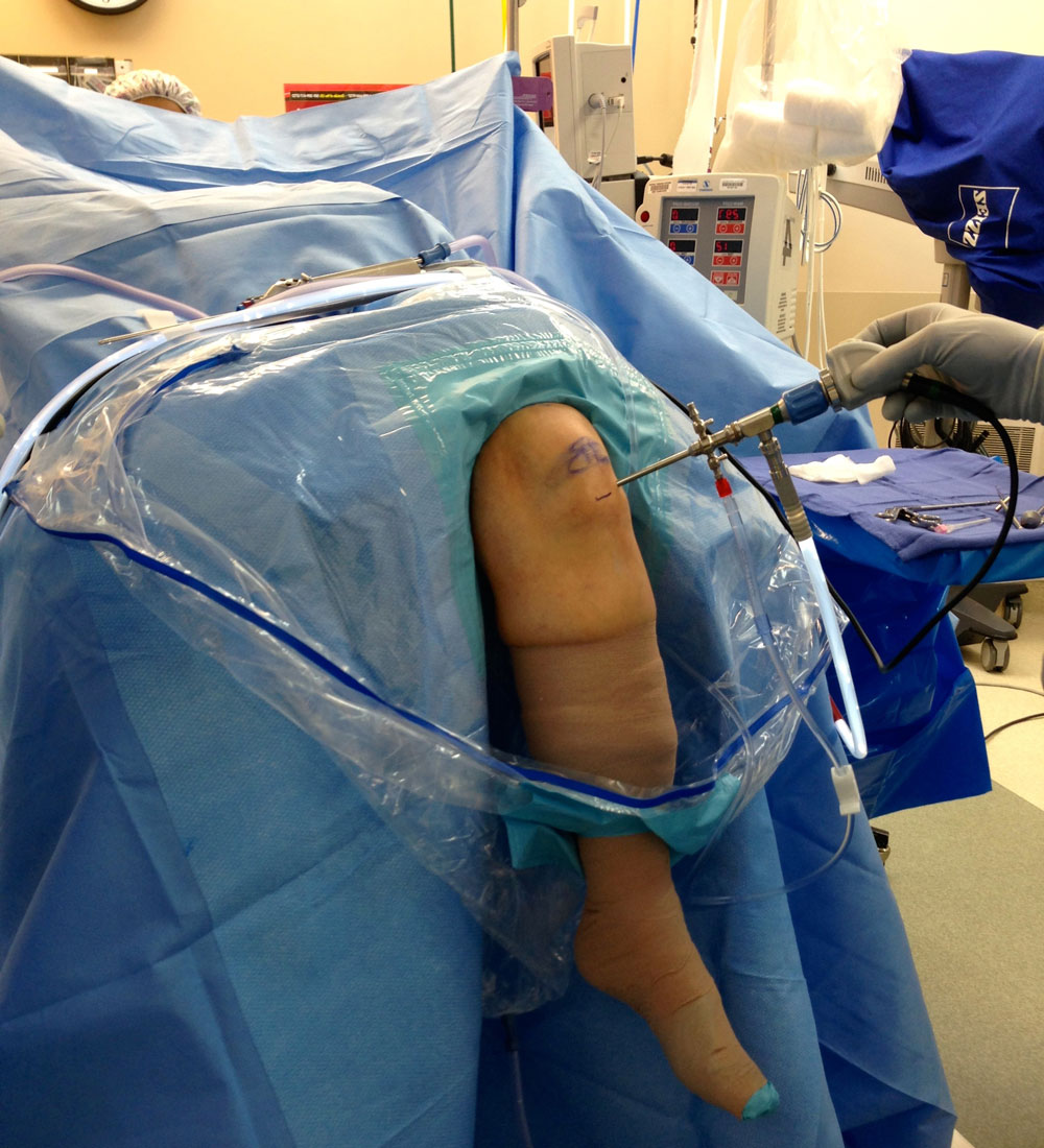 Артроскопия коленного и плечевого суставов